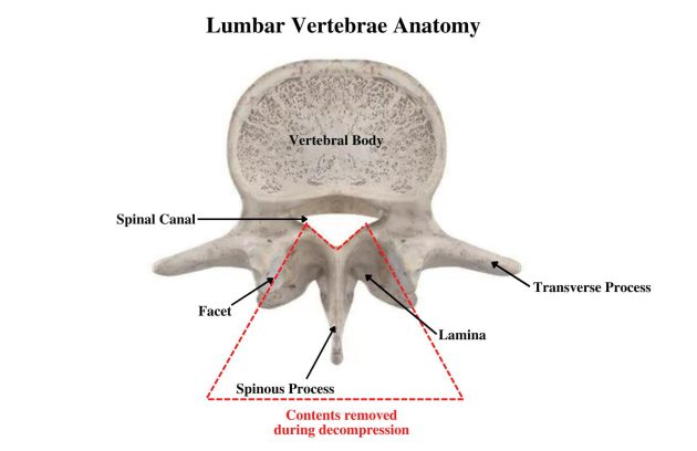 diagram of lumbar vertebrae anatomy