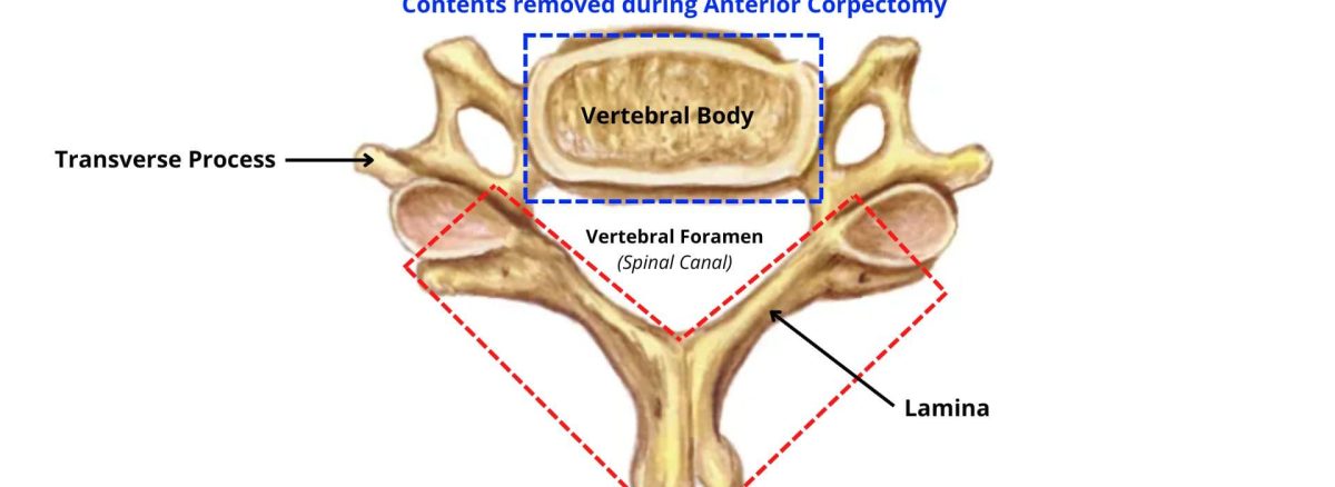 diagram of cervical vertebrae anatomy